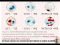 Uncertainty Quantification for Motor Imagery BCI - Machine Learning vs Deep Learning