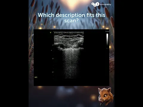 Which description fits this scan?