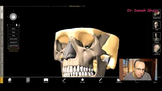 skull overview