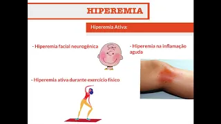 Hiperemia (Distúrbios Circulatórios PARTE I) - Patologia