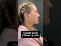Download Lagu Facelift op 53-jarige leeftijd - Update na 1 week (interview)
