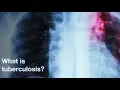 What is tuberculosis