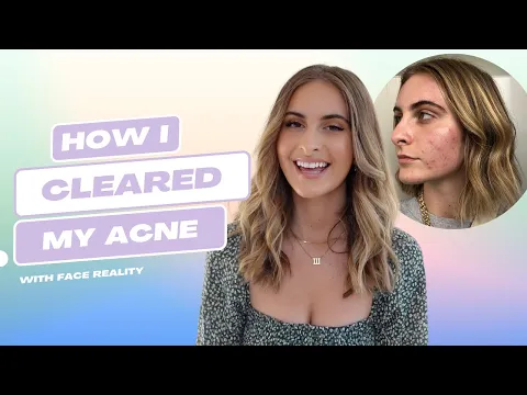 Download MP3 My Experience with the Face Reality Acne Program