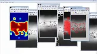 Laplacian of Gaussian Matlab Code 3D Projects