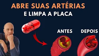 Abre as ARTÉRIAS e Reduz a PLACA || Dr. Moacir Rosa