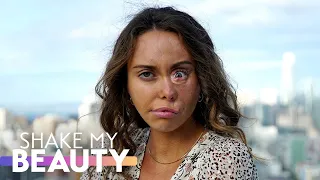 my cleft scars are my favourite feature shake my beauty