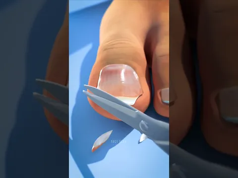 Never Cut Your Toenails Like This! 😱