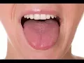Download Lagu De eerste 5 symptomen van tongkanker