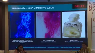 AIOC2026 FP753 Dr Rohan Madan Emerging Role of Meyerozyma Species in Fungal Keratitis Clinical an