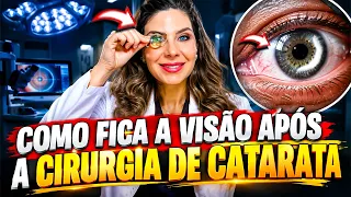 COMO FICA A VISÃO APÓS A CIRURGIA DE CATARATA? (O Que Ninguém Te Conta)