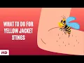 Download Lagu What To Do For Yellow Jacket Stings