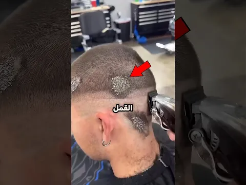 لن تصدق ماذا وجد الحلاق في شعر هذا الصبي! 🤯🤢