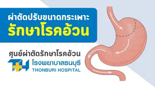  ค่า BMI เท่าไหร่ถึงจัดว่าเป็นโรคอ้วน 