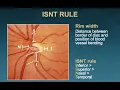 The 5 Rs of Examining the Optic Disc Malik Y Kahook MD