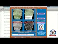 Maize Leaf Disease Detection Using Deep Learning CNN With Source Code Matlab Project Code