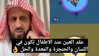 عقد العين عند الاطفال تكون في اللسان والحنجرة والمعدة والحل الشيخ فهد القرني 