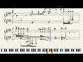 "Flower Fields" - Kirby's Epic Yarn (Sheet Music Transcribed by Computer)
