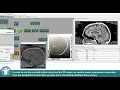 MeVisLab Tutorials - Image Processing