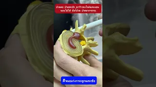  ทำไมถึงปวดคอจนขยับไม่ได้ และเกิดจากอะไร 