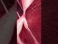 Download Lagu 3d animation of the Tricuspid Valve  #meded #anatomy #3dmodel
