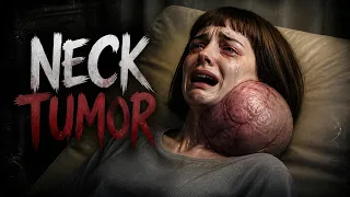 Neck Tumor HD 3min