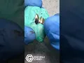 Making Gold Teeth Adding diamond cuts and Diamond dust