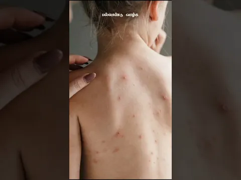 தினமும் ஐந்து அழகு குறிப்புகள் #skincareroutine #skincaretips #beautycare #beautycaretips #tamiltips