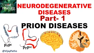 NEURODEGENERATIVE DISEASES PART 1: PRION DISEASES