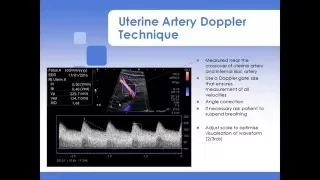 Advanced Fetal Doppler Webinar with Piotr Niznik