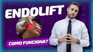 Como funciona o Endolift a laser?