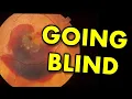 Can Dry AMD Turn Into Wet AMD What You Need to Know