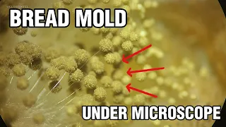 Moldy Bread Under A Microscope (SPORANGIA)