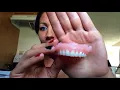 How my dentures look with Densurefit and gum healing update