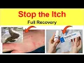Scabies Treatment That Works Full Recovery Tips