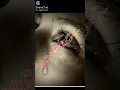 Download Lagu Umma vitta yaarum illa| WhatsApp status