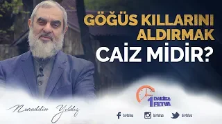 Göğüs kıllarını aldırmak caiz midir?