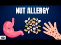 Nut Allergy Everything You Need To Know