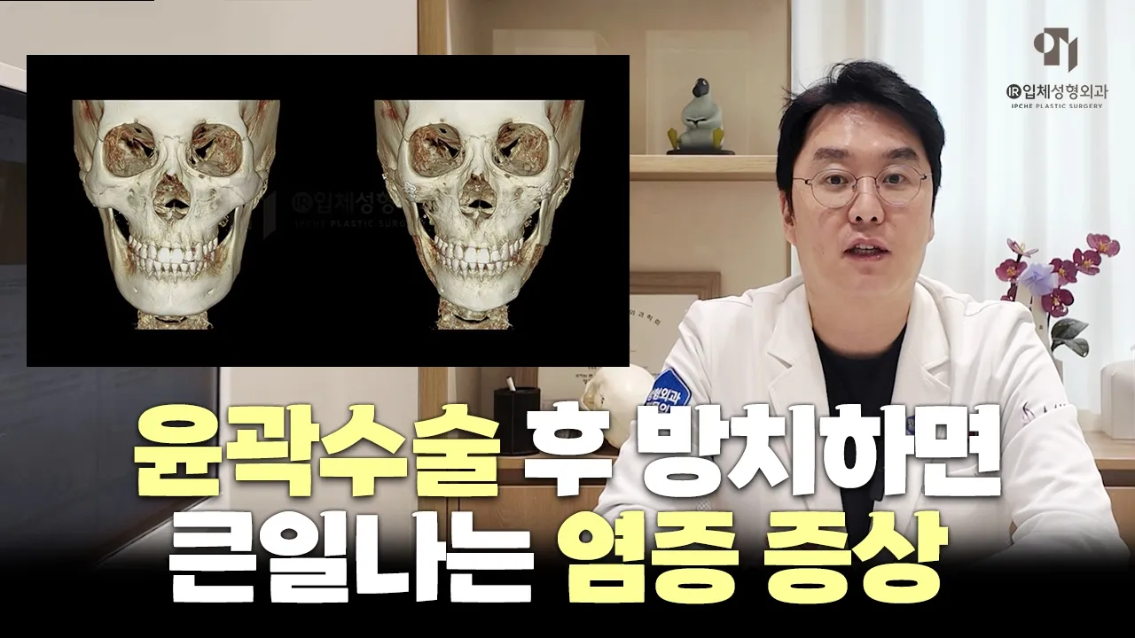 안면윤곽수술 부위별 염증 가능성과 치료법