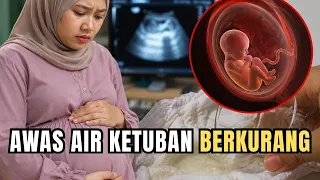 Kenapa Air Ketuban Bisa Berkurang? Ini Penyebab yang Sering Tidak Disadari
