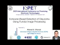 ICEPT 2020 Computer-Based Detection of Glaucoma Using Fundus Image Processing