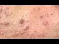 Satisfying and Relaxation with SURI NGUYEN Beauty Spa