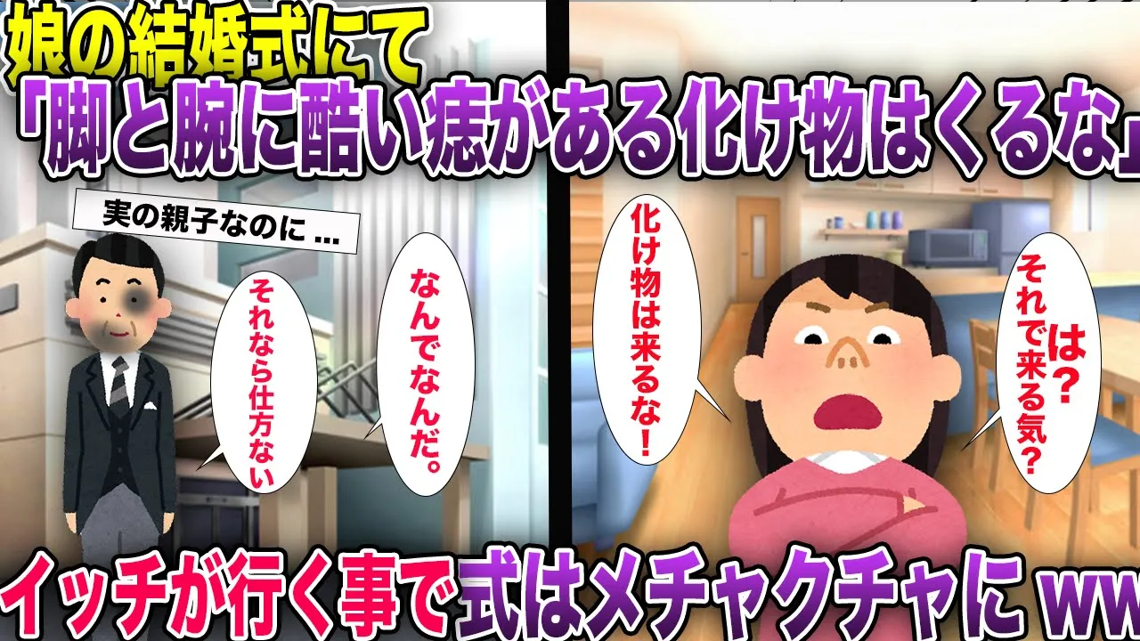 25年間大切に育ててきた娘の結婚式に「脚と腕と醜い痣がある化け物はくるな」→イッチが行く事で式はメチャメチャにwww【2ch風スカッと・ゆっくり解説】
