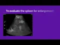 Vscan Air Using presets for evaluations spleen