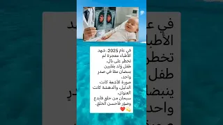 في عام 2025 شهد الأطباء معجزة لم تخطر على بال طفل و لد بقلبين ينبضان لايك اشتراك ترند اكسبلور 