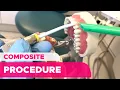 Step by Step Dental Assisting Training for Composite Restorations