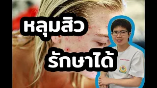  หลุมสิวมีกี่ระดับความรุนแรง และแต่ละระดับมีลักษณะอย่างไร 