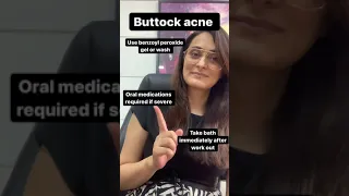Buttock acne causes and treatment