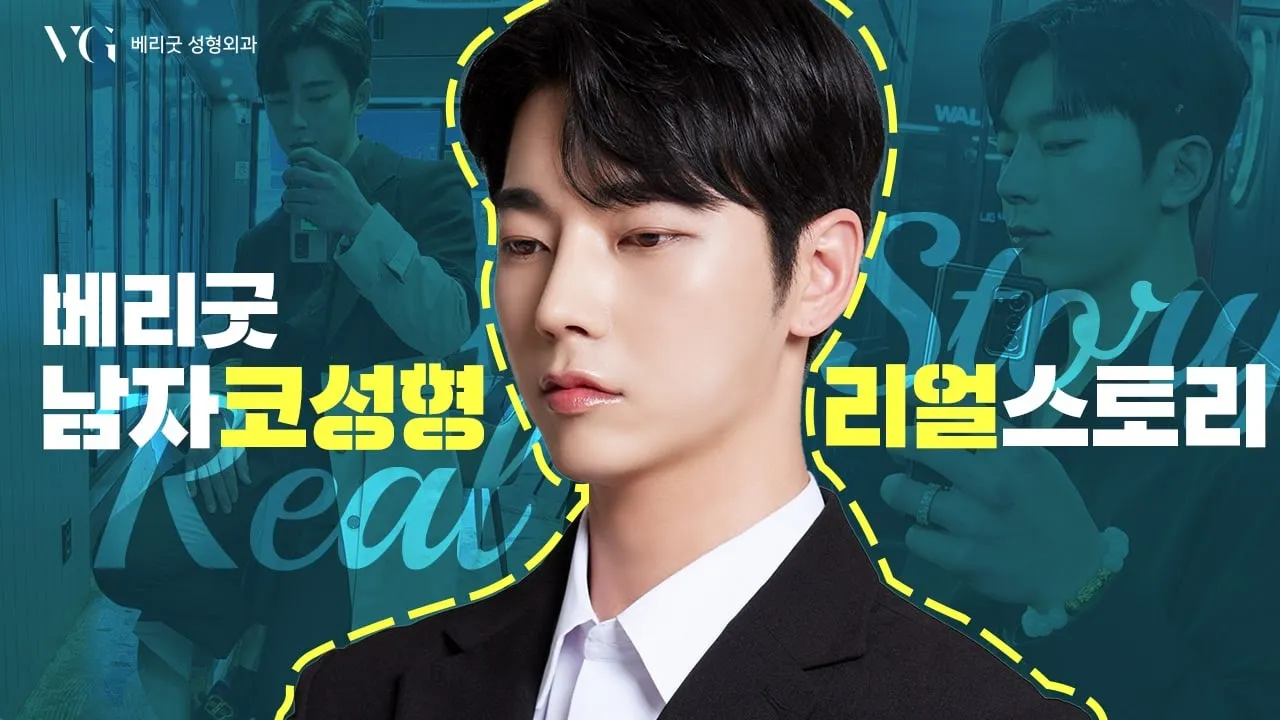 #베리굿성형외과 매일매일 멋있어! 자신감 가득✨오똑하고 화려한 남자코성형 리얼스토리