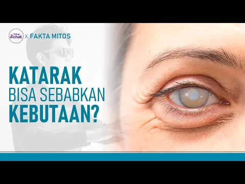 Gejala Ringan Hingga Parah Mata Katarak
