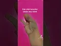 Download Lagu Cara Mudah Cek Otak, Beresiko Stroke atau Tidak